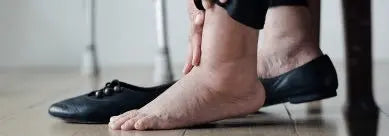 What Causes Swollen Legs and Feet? Understanding the Root Causes